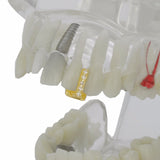 K GP Top or Bottom CZ Tooth Gap GRILLZ - FANATICS365